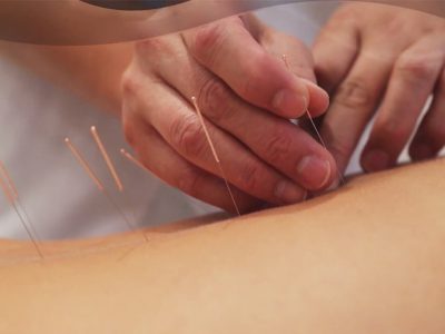 Combatting Stress Using Acupuncture