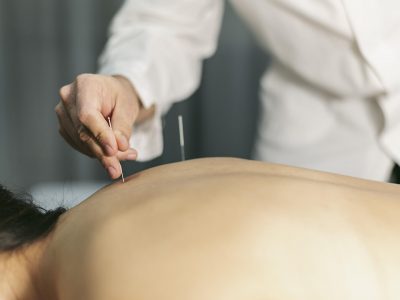 What conditions are best treated with acupuncture?