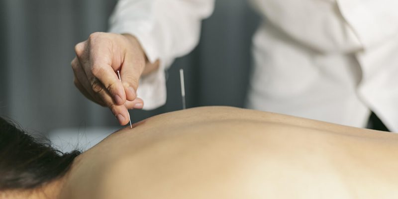 What conditions are best treated with acupuncture