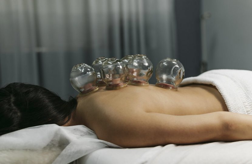 What is cupping and what are the benefits for you