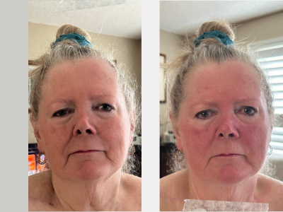 Connective Tissue Massage – NATURAL FACELIFT. Coming soon!